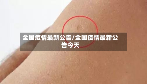 全国疫情最新公告/全国疫情最新公告今天