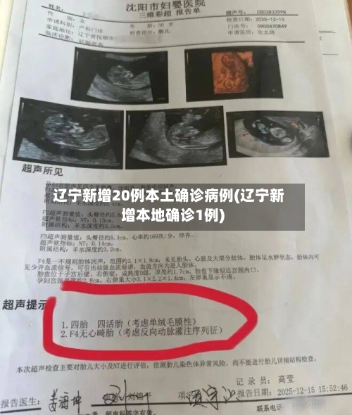 辽宁新增20例本土确诊病例(辽宁新增本地确诊1例)-第3张图片