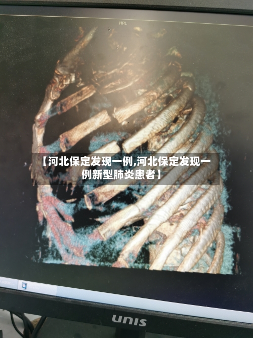 【河北保定发现一例,河北保定发现一例新型肺炎患者】-第2张图片
