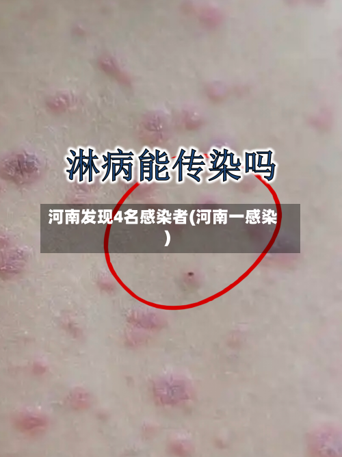 河南发现4名感染者(河南一感染)-第2张图片